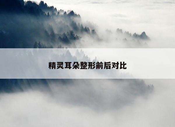 精灵耳朵整形前后对比
