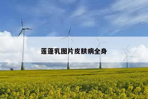 莲蓬乳图片皮肤病全身